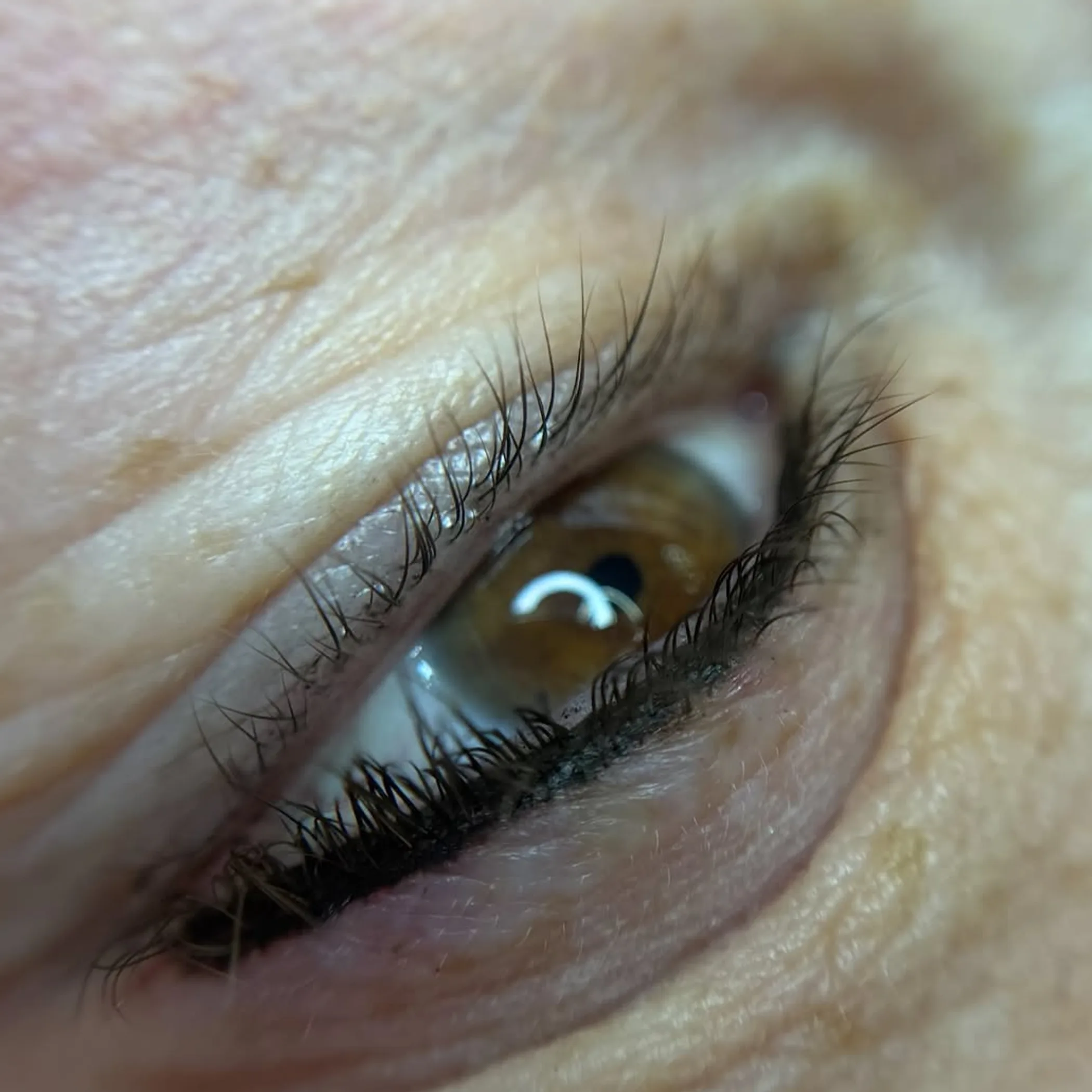 eyelid with tattooed eyeliner
